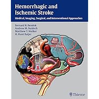 健康・医学 Decision Making in Neurovascular Disease Decision Making in Neurovascular Disease: 9781684200573